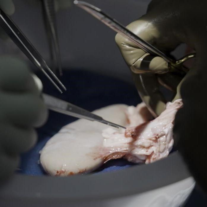 Pig kidney works in a donated body for over a month, a step toward animal-human transplants